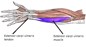 Extensor carpi ulnaris muscle