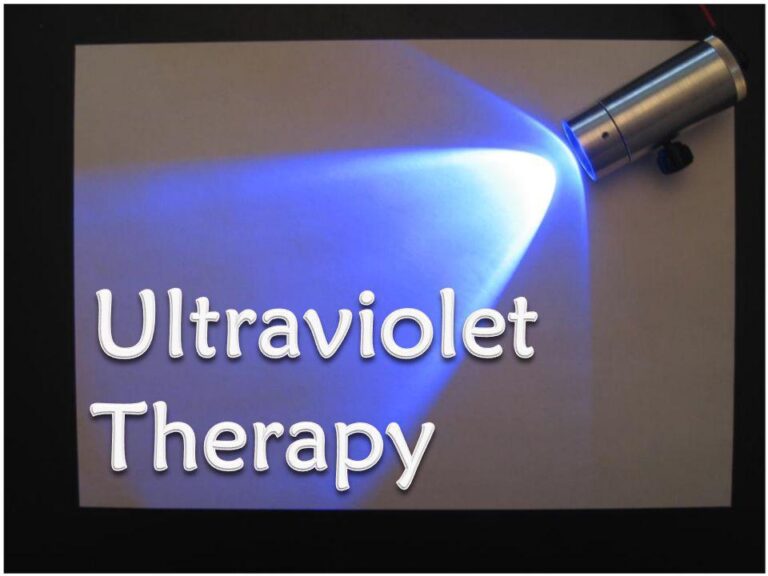 Use of UVR Therapy in Physiotherapy : Ultraviolet Therapy