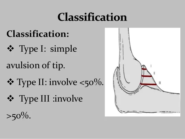Classification of the Elbow Fracture