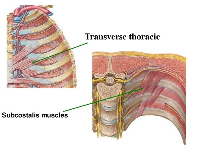 subcostal muscles