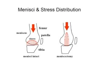 stress distribution of menisci