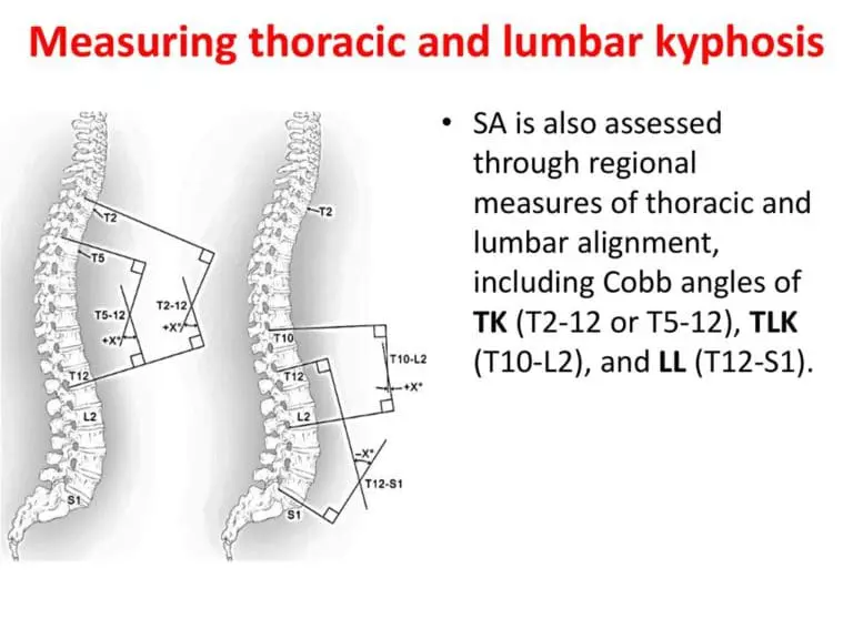 Thoracic kyphosis Measurement