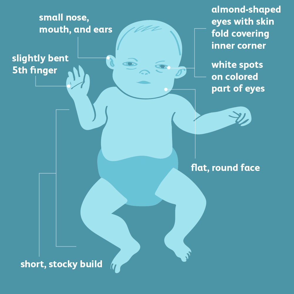 Bone Diseases Types Causes Symptoms Treatment Bone Diseases Types Causes Symptoms Treatment