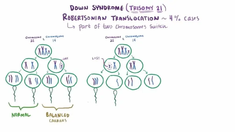 Down syndrome