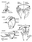 Guyon Canal Syndrome : Cause, Symptom's, Physiotherapy Exercises