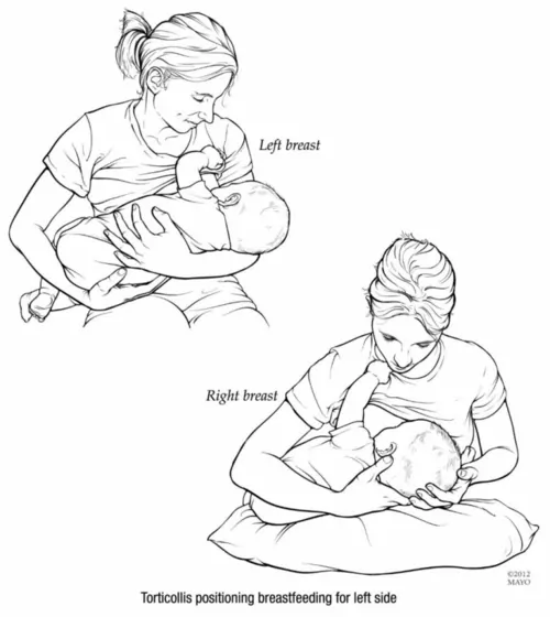 Feeding positions