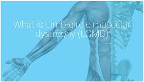 Limb-girdle muscular dystrophy (LGMD): Physiotherapy Exercise
