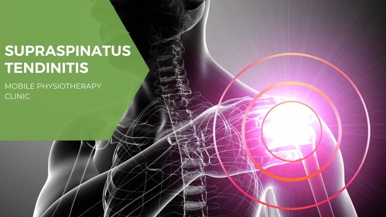 All You Need to Know About Supraspinatus Tendinitis