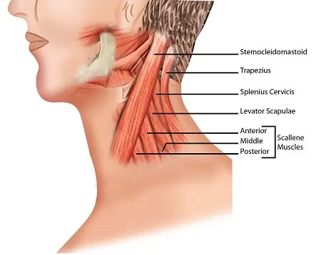 Torticollis-anatomy