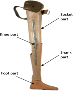 ABOVE KNEE AMPUTATION : Indication, Exercise, Prosthesis