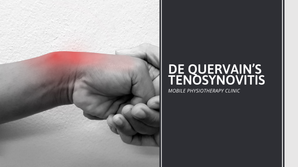 De Quervain’s Tenosynovitis Samarpan Physiotherapy Clinic Ahmedabad