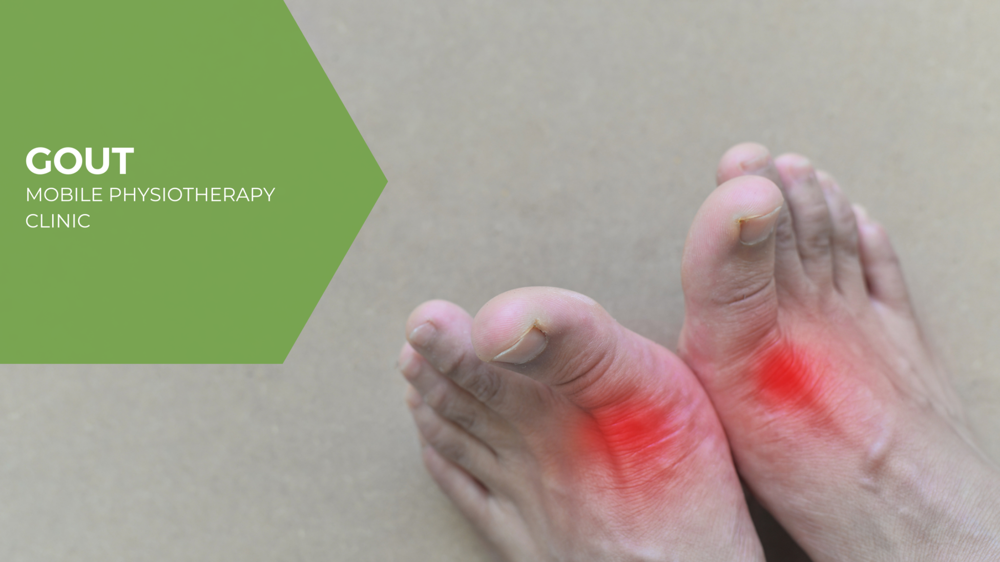 gout-samarpan-physiotherapy-clinic-ahmedabad