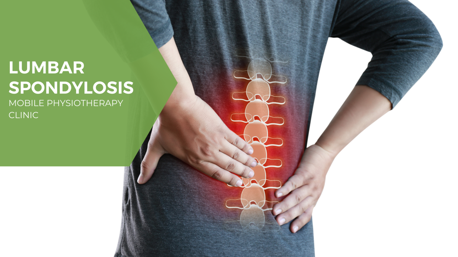 Lumbar Spondylosis - Samarpan Physiotherapy Clinic Ahmedabad