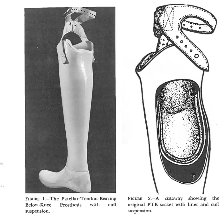 Patellar Tendone bearing(PTB)Prosthesis