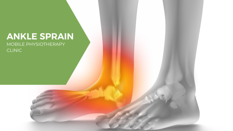 Ankle Sprain : Cause, Symptoms, Diagnosis, Physiotherapy Treatment, Exercise