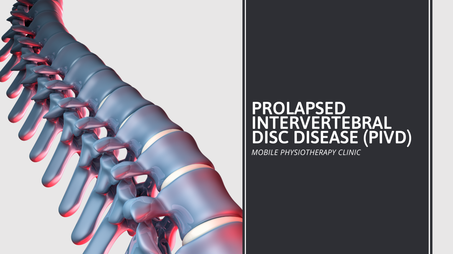 Prolapsed Intervertebral Disc Disease Pivd