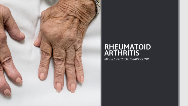 Rheumatoid Arthritis : Cause, Symptoms, Diagnosis, Treatment, Exercise