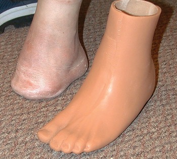 Foot Prosthesis