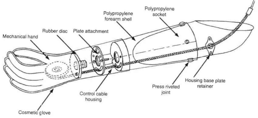 Below-elbow-prosthesis