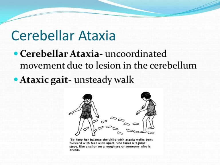 Cerebellar Ataxia: Cause, Symptoms, Diagnosis, Treatment, Exercise