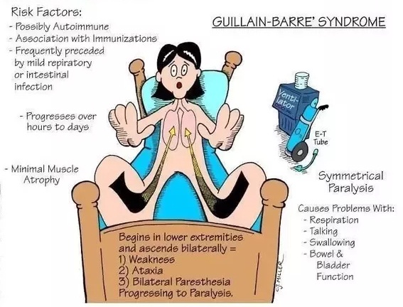 symptoms of Guillain-Barre syndrome