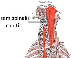 Semispinalis Cervicis
