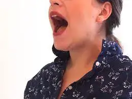 Open wider (Mouth opening exercise)