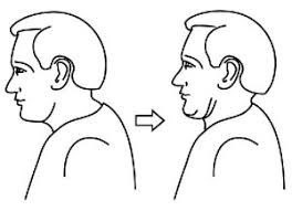 Chin tuck exercise