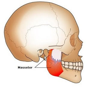 The masseter muscle Anatomy