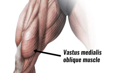 Vastus medialis muscle exercise