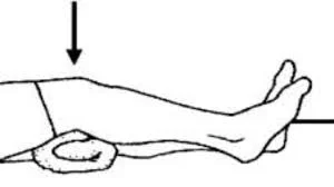 Quadriceps Set (static quadriceps exercise)