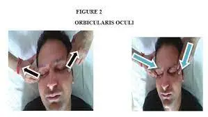 PNF Exercises for Orbicularis oculi muscle 