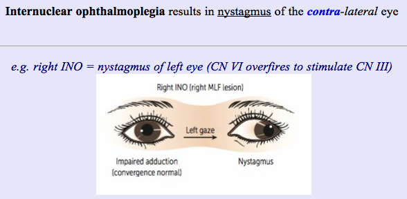 Nystagmus - Cause, Symptoms, Treatment, Exercise