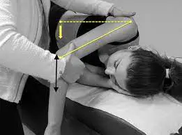 posterior-capsule-stretch