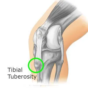 Tibial Tuberosity Anatomy