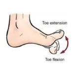 teo-flexion-and-extension