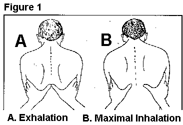 Thoracic expansion exercise