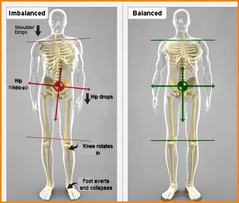 Anterior Pelvic Tilt, Explained: How the Angle of Your Hips Can Throw Your  Entire Body Out of Alignment