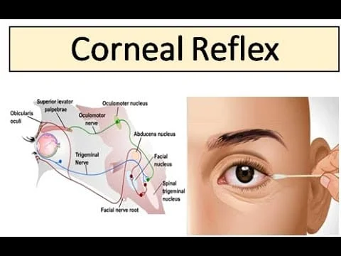 Blink Reflex (Corneal Reflex)