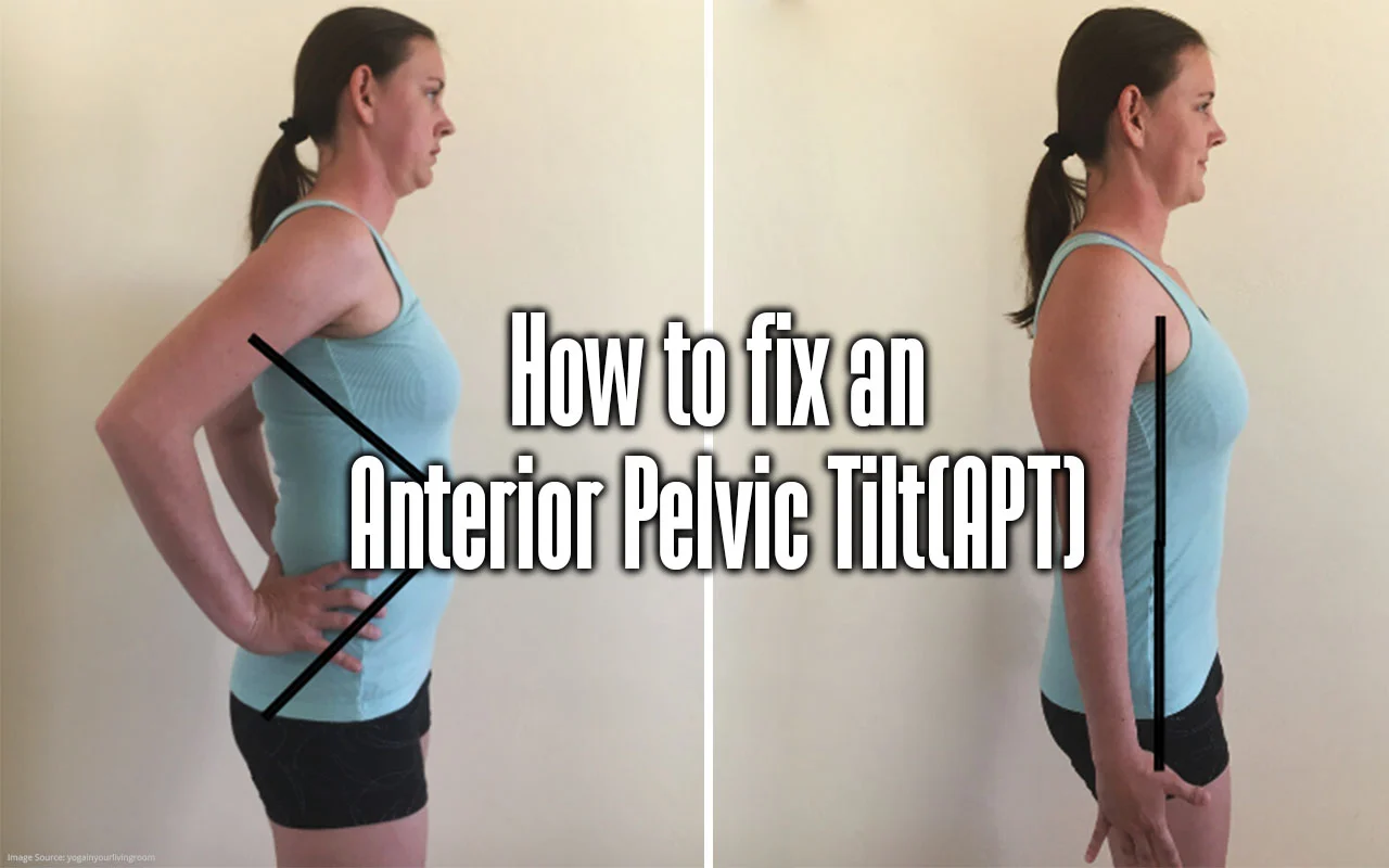 how-to-fix-an-anterior-pelvic-tilt