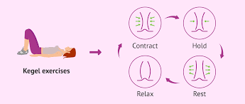 Kegel exercises