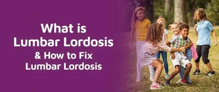 How to Fix Lordosis Naturally