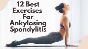 12 Best Exercises for Ankylosing Spondylitis