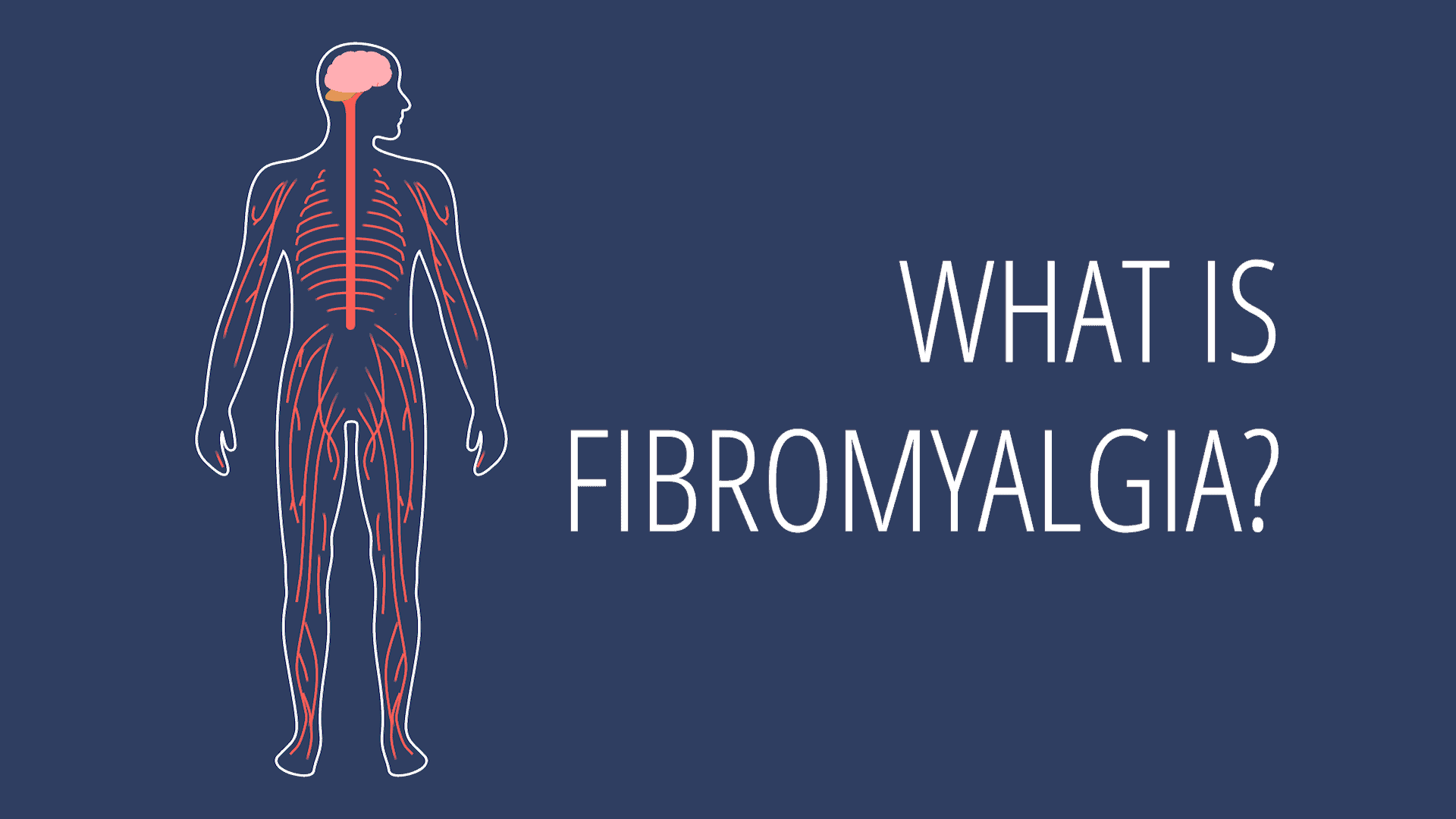 What is Fibromyalgia